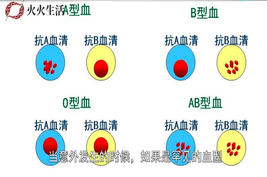 a型血为什么叫贵族血